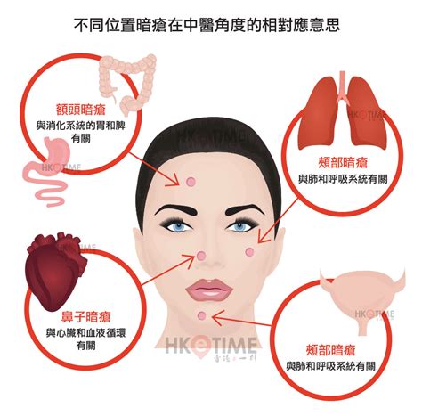 暗瘡位置意思